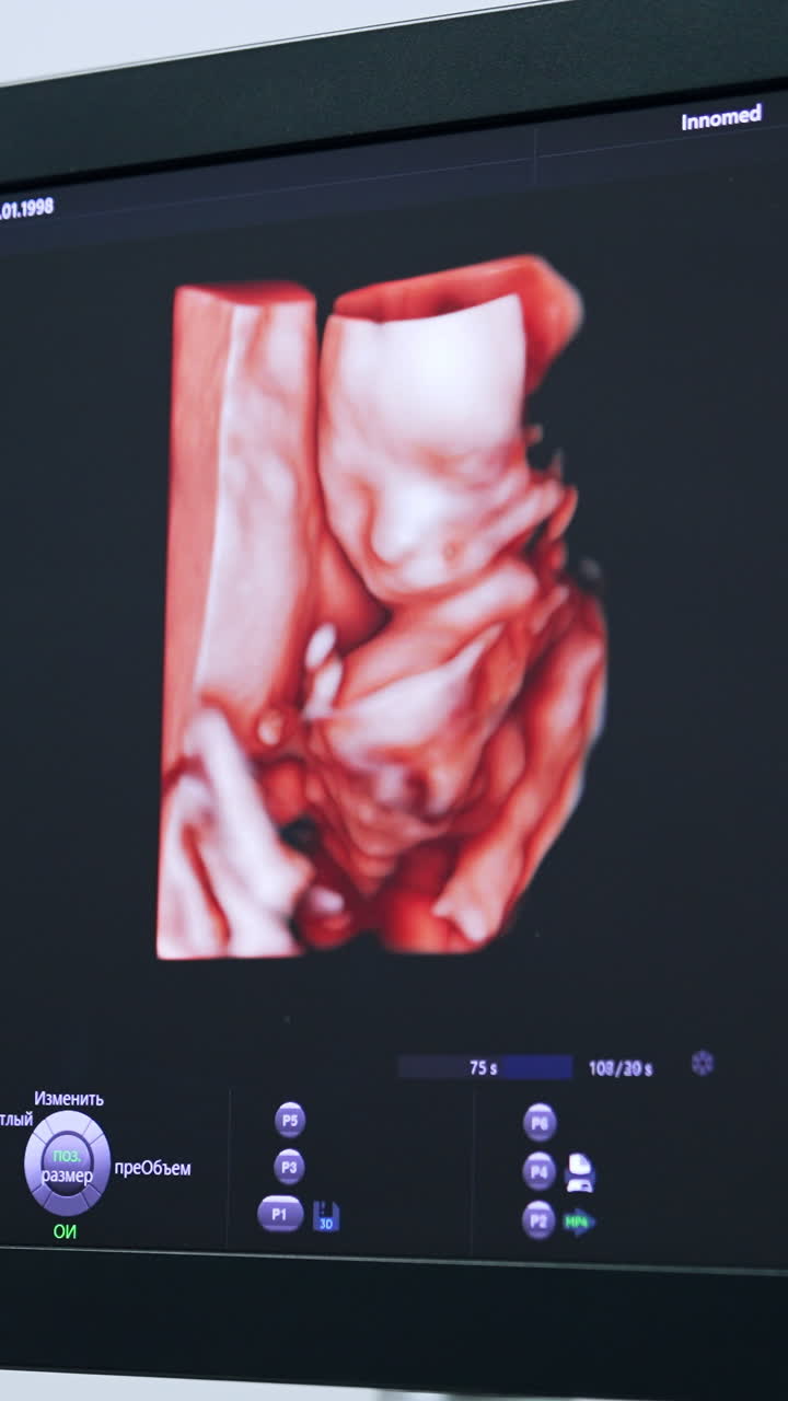 3d image of an unborn baby on the monitor of ultrasound machine. Pregnancy check up. Vertical video