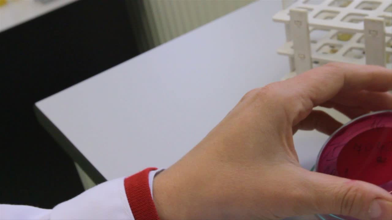 페트리 접시 샘플