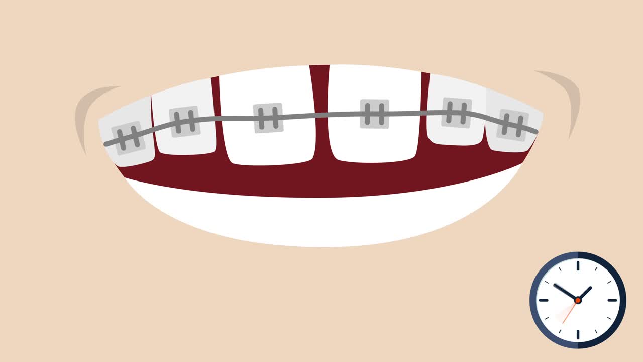 2D Animation of teeth growing back in place with braces timelapse