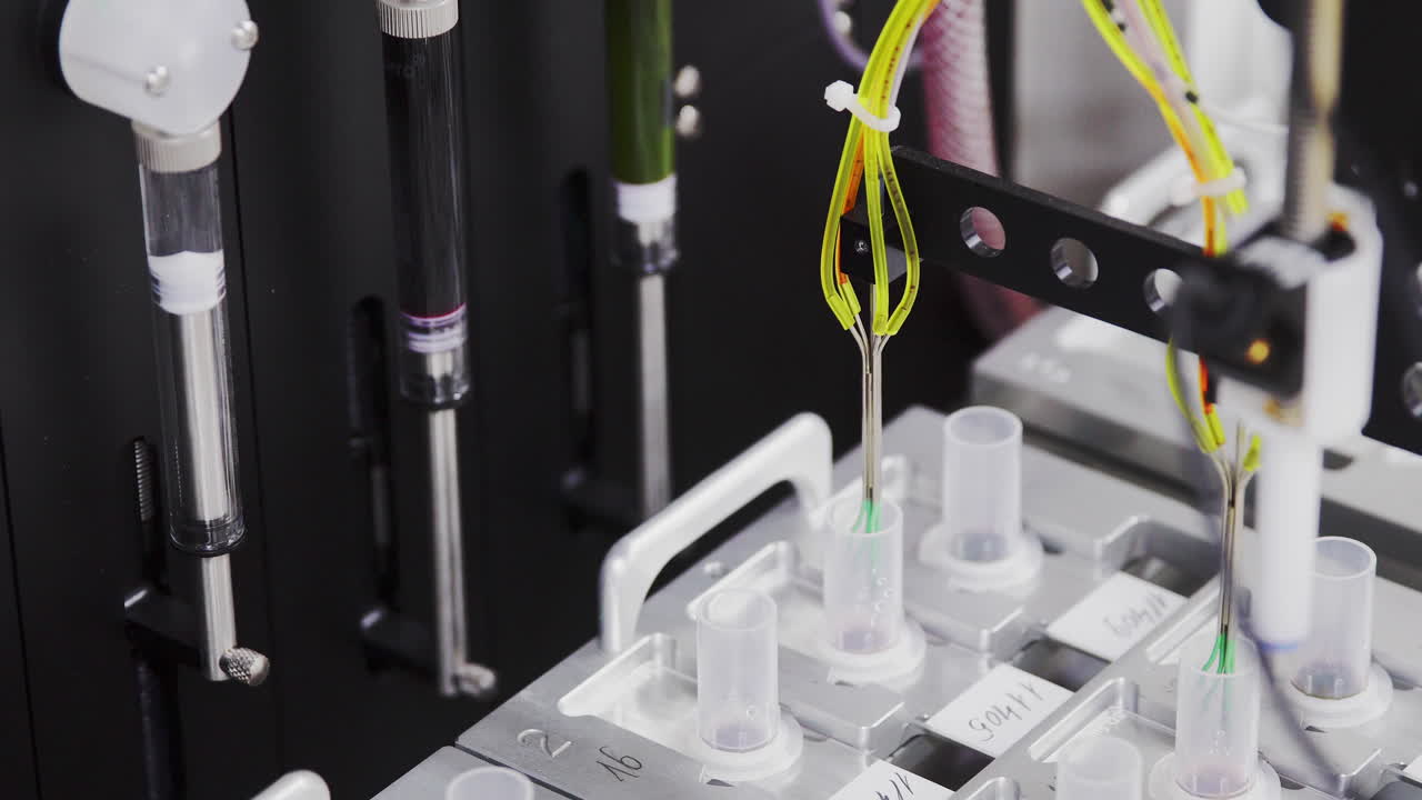 기술적으로 첨단 자동화된 실험실에서 클리닉은 당뇨병을 퇴치하기 위한 연구를 수행하고 있습니다. 혈액과  ⁇ 장의 세포에 대한 깊은 분석입니다.