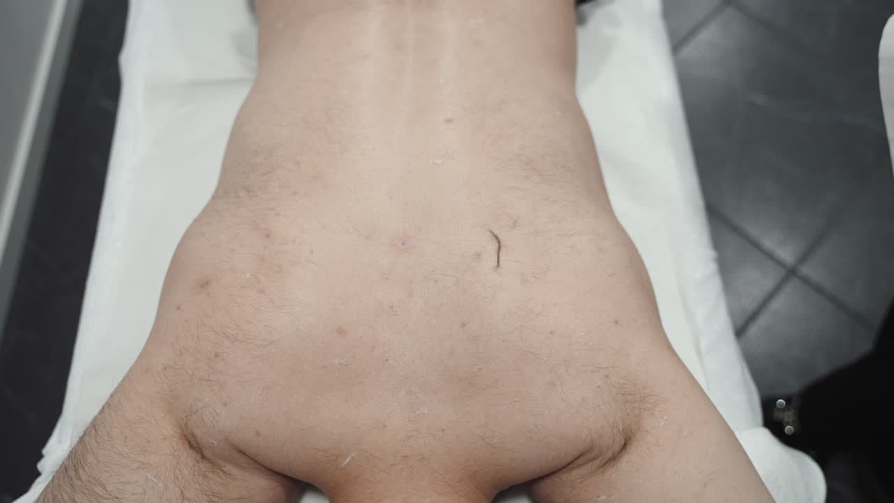 afeitación detallada de la espalda antes de la sesión de láser - vista de cerca de arriba