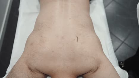 레이저 세션 전에 세부적인 등 면도 - 가까운 위쪽 보기