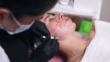 Anti-aging procedure: professional cosmetologist makes multiple injections in woman&#039;s face skin during mesotherapy