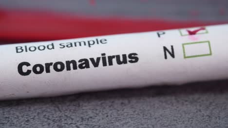 prueba de muestra de sangre de coronavirus