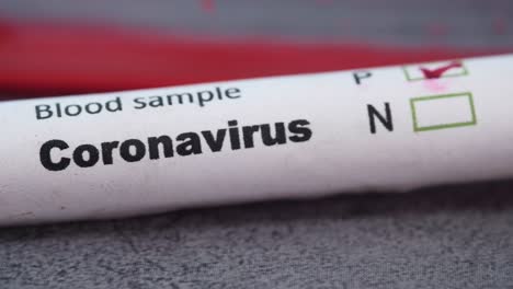 coronavirus blood sample test