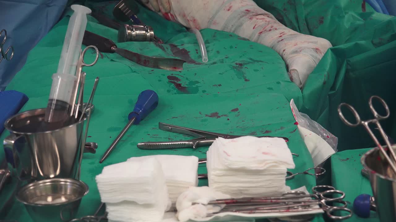 A surgical nurse, also referred to as a theatre nurse or scrub nurse, specializes in preoperative care, providing care to patients before, during and after surgery