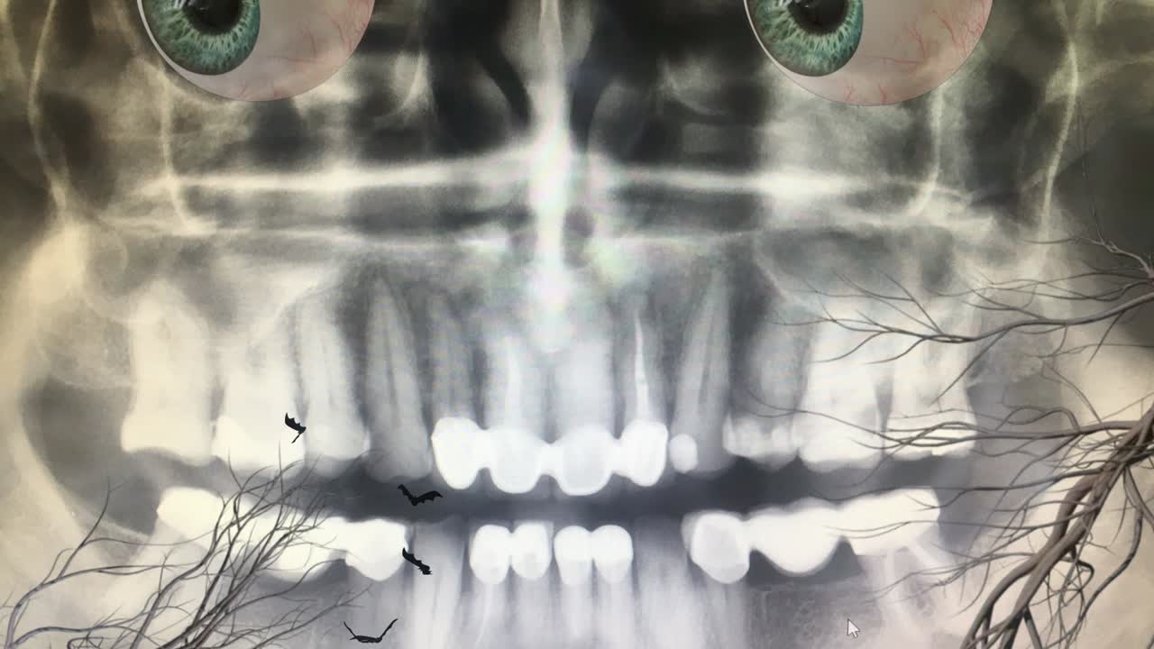 X-Ray Scull with Moving Eyeballs