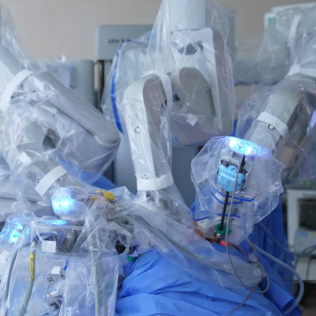 Da vinci bot surgery operation. Robot surgeon working in modern hospital