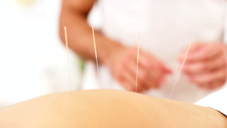 relax, acupuncture therapy