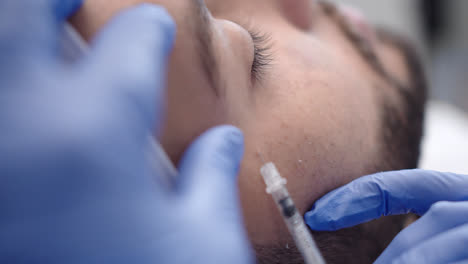 beautiful slow motion shot of botox injection into the face of a young man to correct aesthetic expressions in a dermatological beauty clinic by a female doctor.