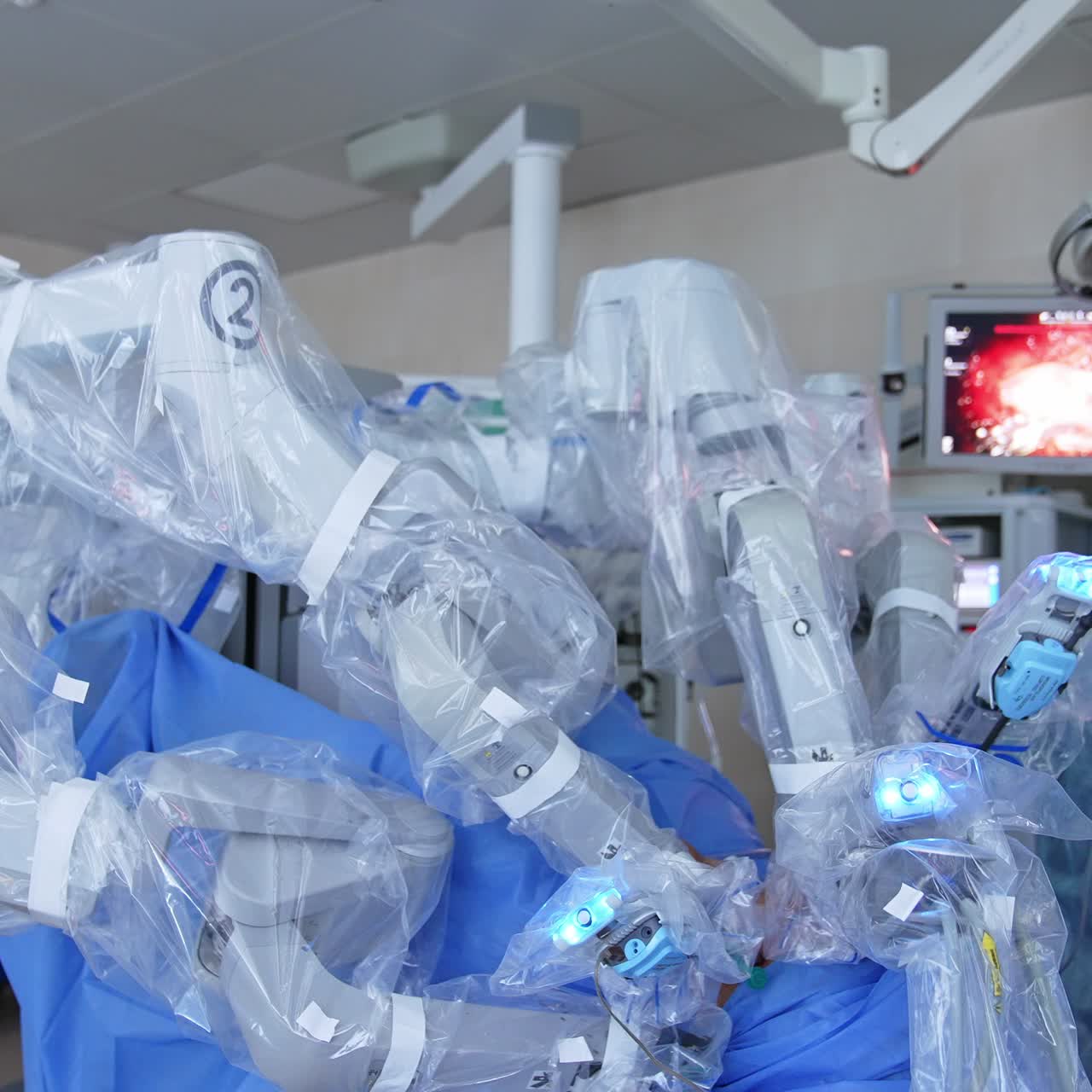 Da Vinci robotic medical equipment performs operation in modern hospital. Male surgeon watches the screen and controls the process