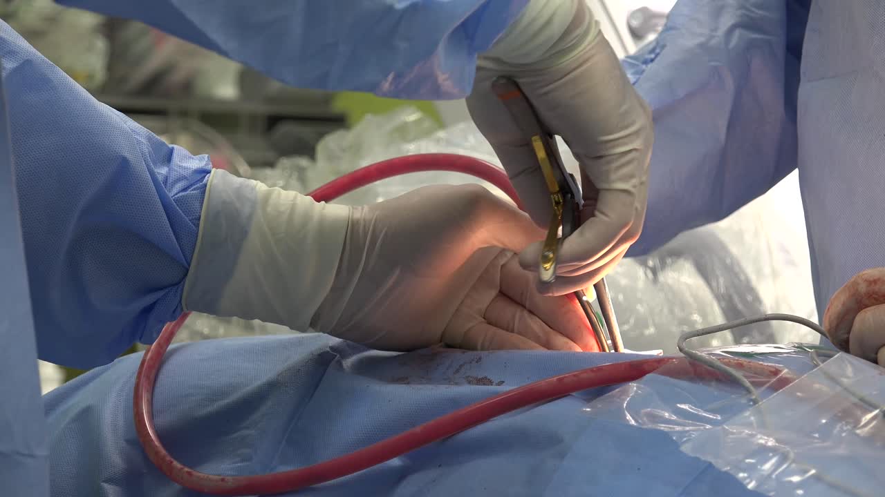 la fusión espinal, también llamada espondilodesis o espondilosíndesis, es una técnica quirúrgica neuroquirúrgica u ortopédica que une dos o más vértebras