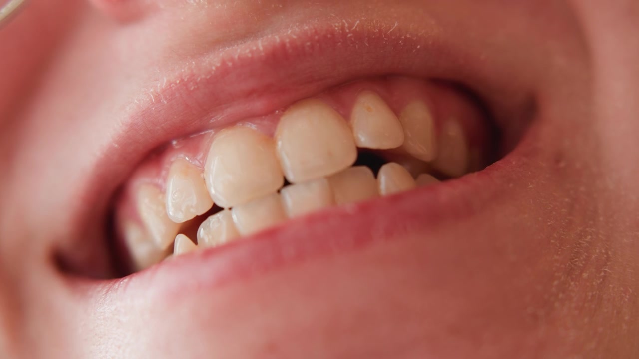Primo piano frontale del viso inferiore che cattura un graduale cambiamento della bocca da labbra compresse e denti tesi a un sorriso dolce con denti parzialmente esposti, dettagli naturali della pelle e un'espressione calma.