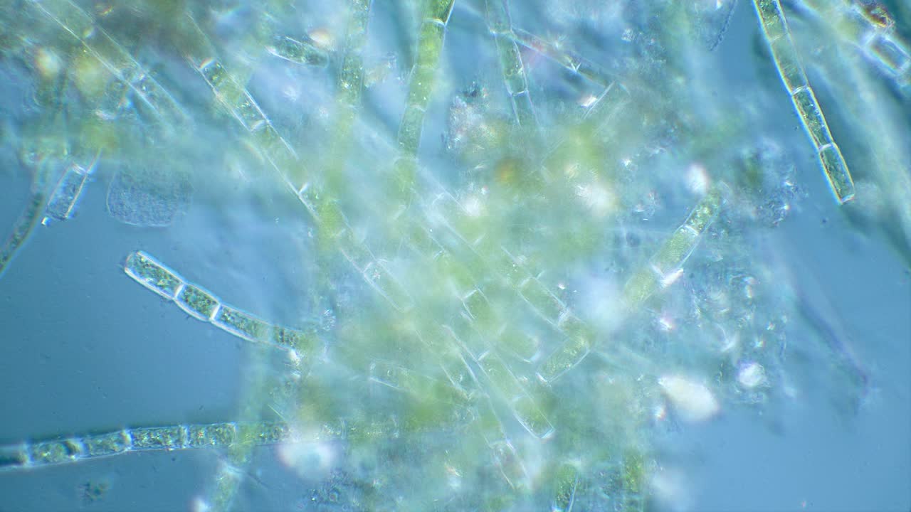 Green algae filaments under microscope