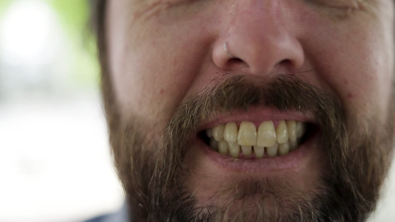 sonrisa dentada de un hombre adulto barbudo