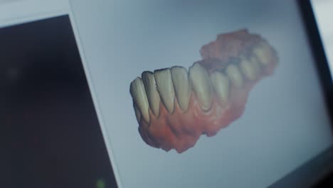 3d model of teeth