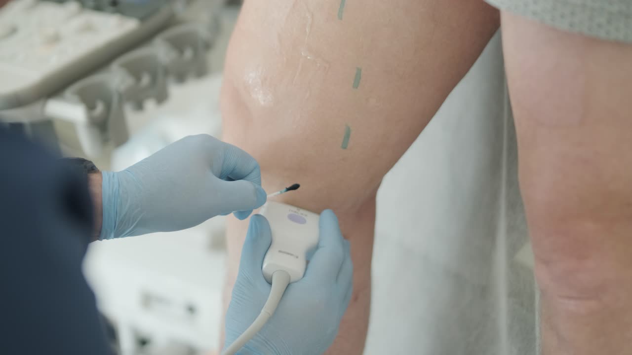 Esame ecografico medico su paziente con ulcera alla gamba