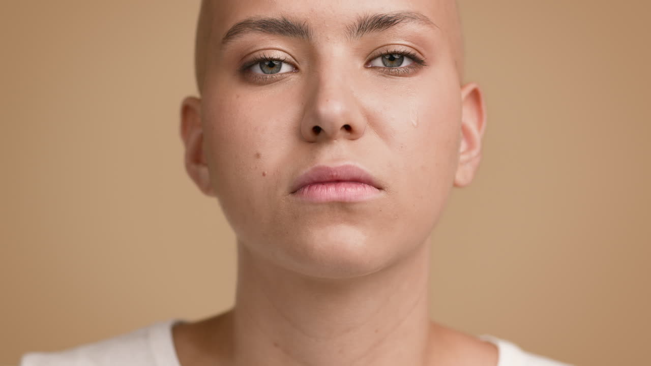 탈모증 을 고 있는 여자 의 초상화