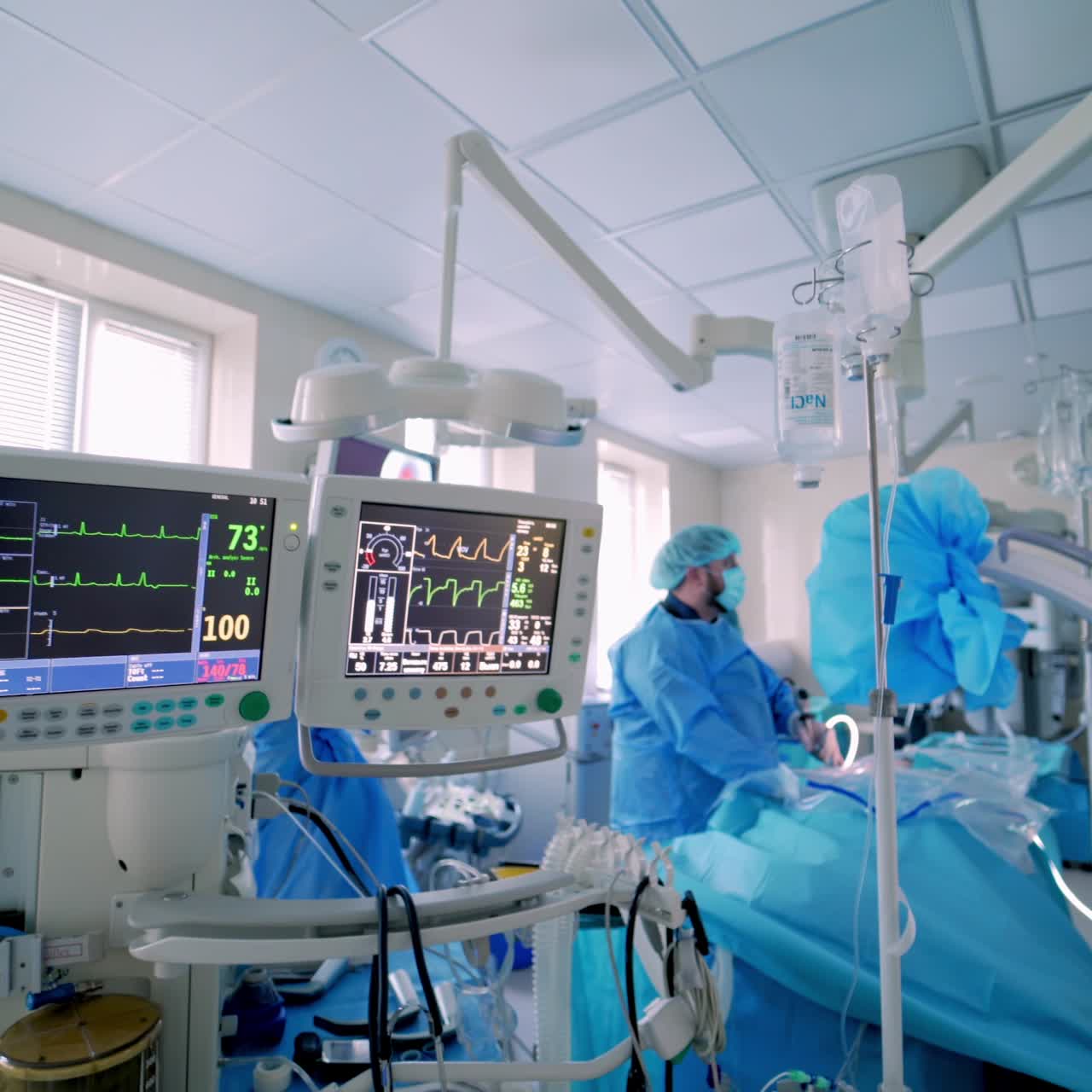 Monitor medico che mostra i parametri cardiaci. Un gruppo di medici esegue un'operazione sullo sfondo. Display con i parametri vitali durante l'intervento. Video.
