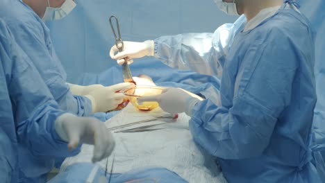 the surgeon prepares a sterile silicone breast implant for breast augmentation surgery