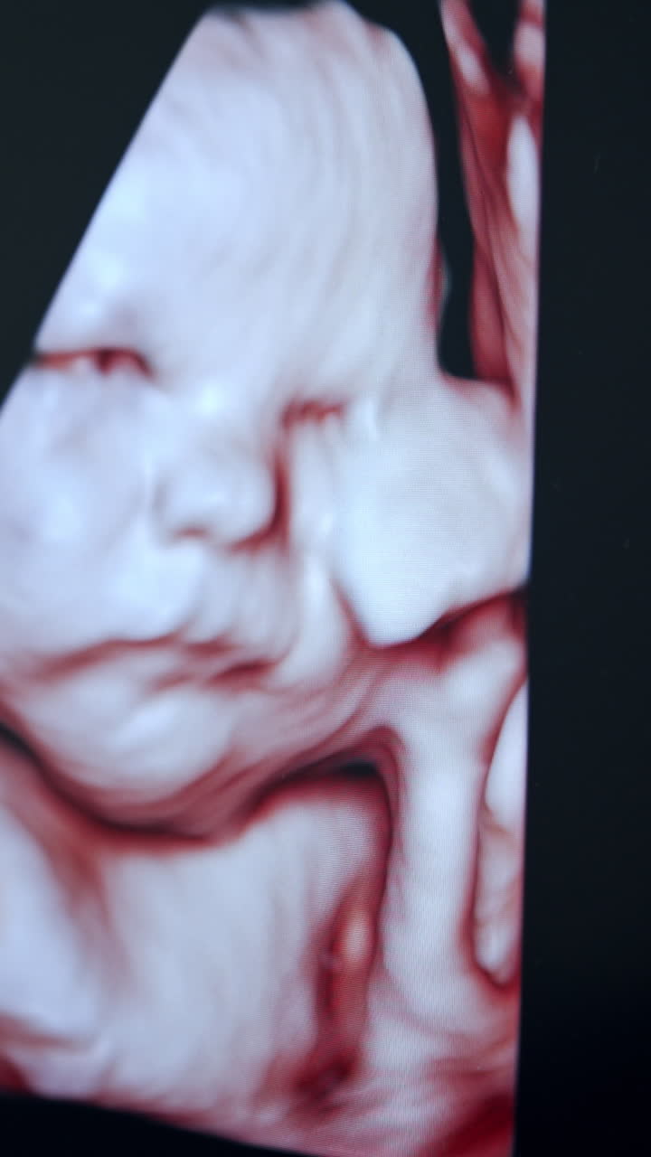 Image of a baby on the screen of an ultrasound equipment. Close up. Black monitor with child in pregnant mum's belly.