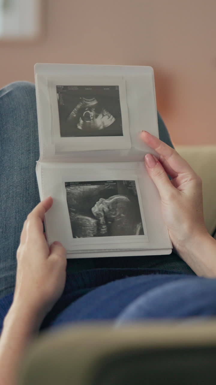 Una donna incinta guarda un'ecografia del suo bambino