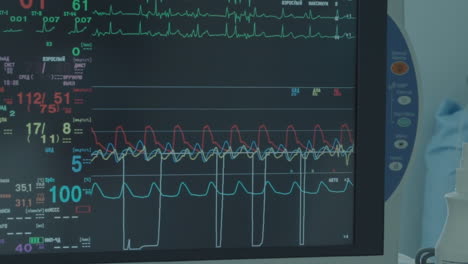 screen displays patient life indicators. real-time cardiac data monitored on digital screen in surgery room during coronary artery bypass surgery