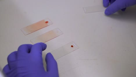 placing drop of blood sample on one end of glass microscope slide - blood film