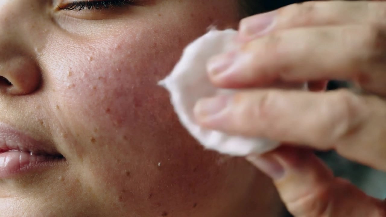 Cotton pad contacting outer cheek, adult Asian woman wiping right cheek at home removing residue