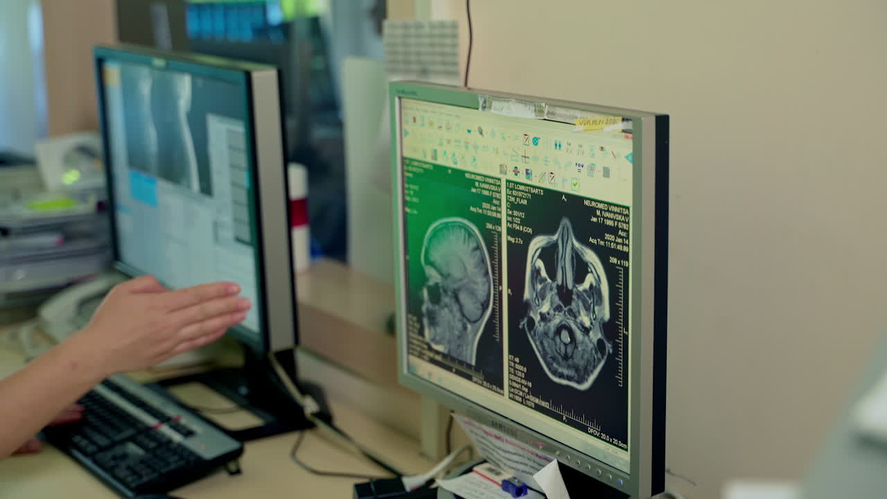 Doctor explaining x-ray. Doctor looking at results of MRI scan