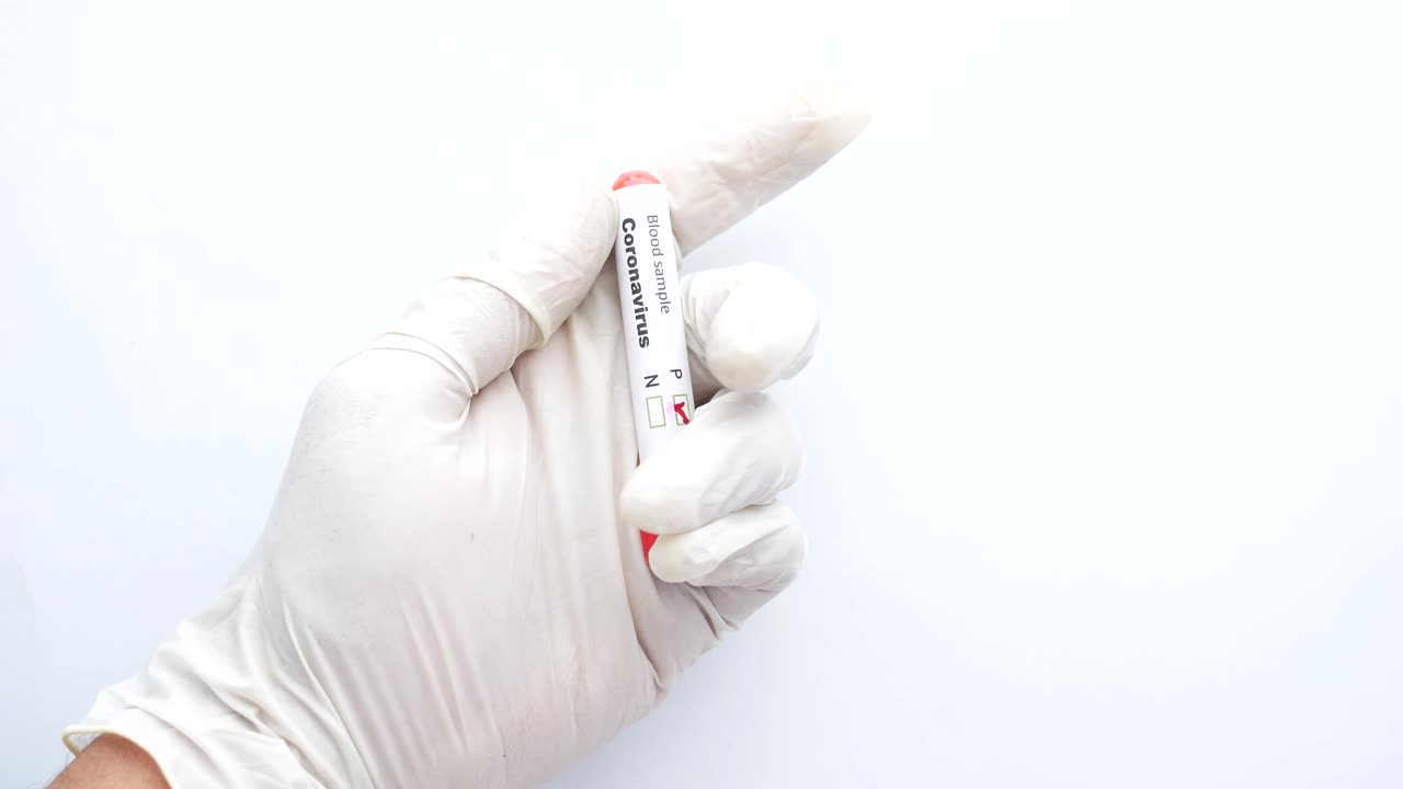 prueba de muestra de sangre de coronavirus
