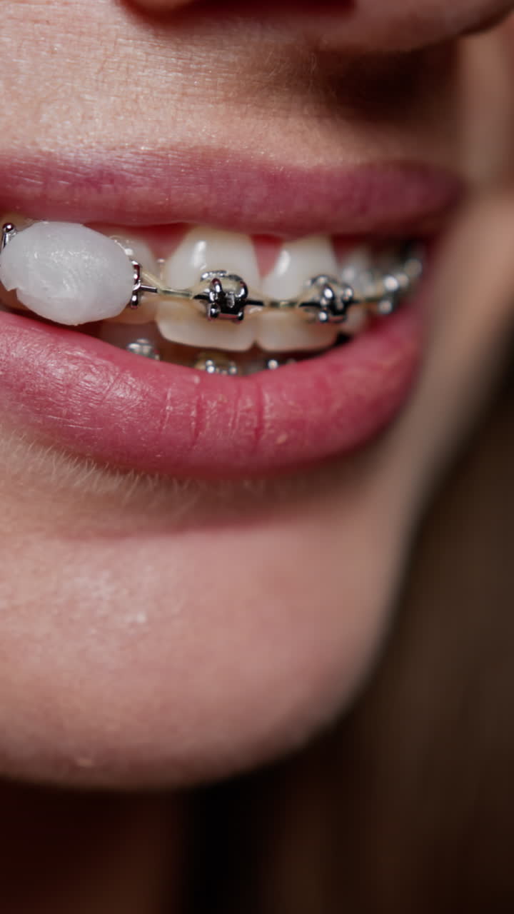 Woman with braces