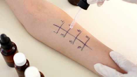 médico haciendo una prueba de pinchazo en la piel de su paciente