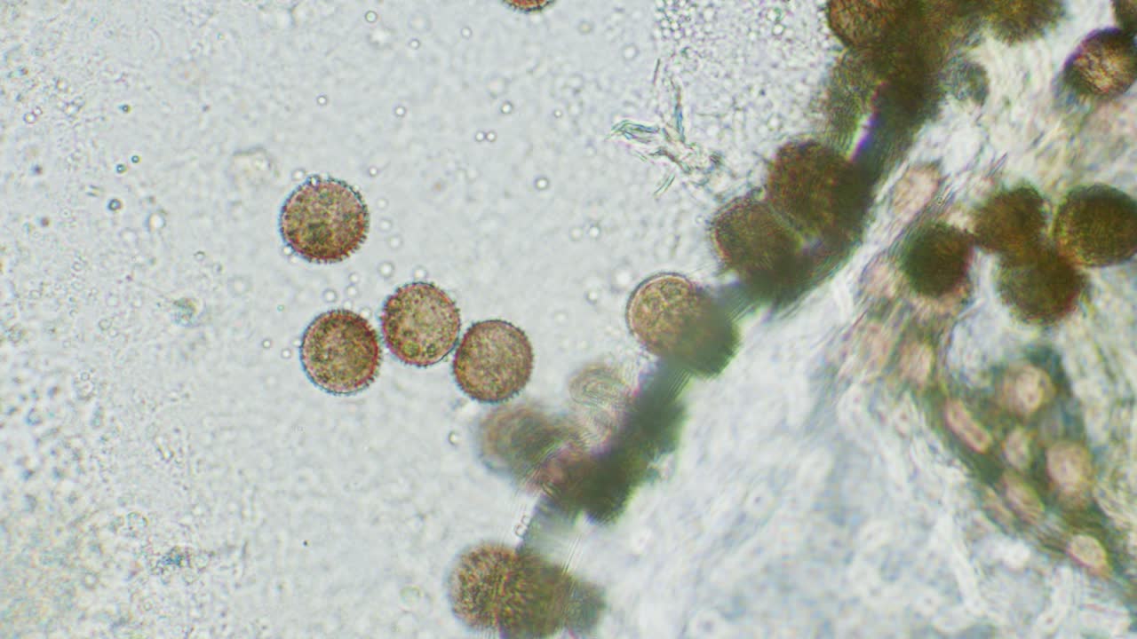 Slime mold spores in large magnification with visible surface details