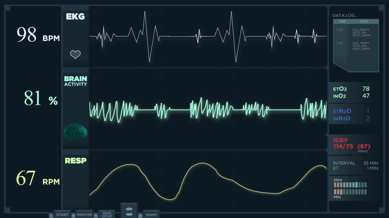 생체 징후를 나타내는 의료 모니터