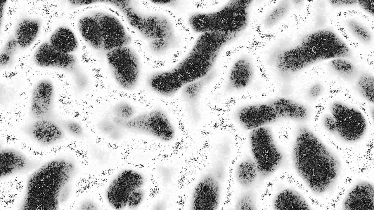 Frenesi alimentar intenso de bactérias em infecção abstrata de germes da microbiologia