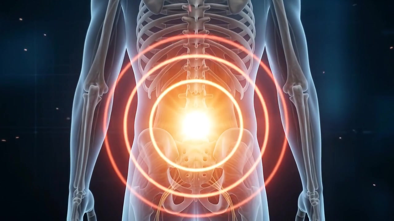 Animação Médica de Dor Lombar Humana e Inflamação Nervosa