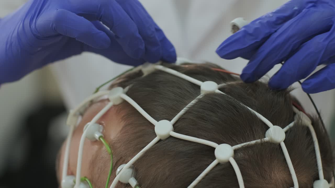 тестирование мозга пациента с помощью энцефалографии в медицинском центре