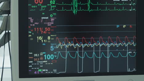 digital life indicators on monitor. advanced digital technology monitors and controls patient vital signs during coronary artery bypass operation