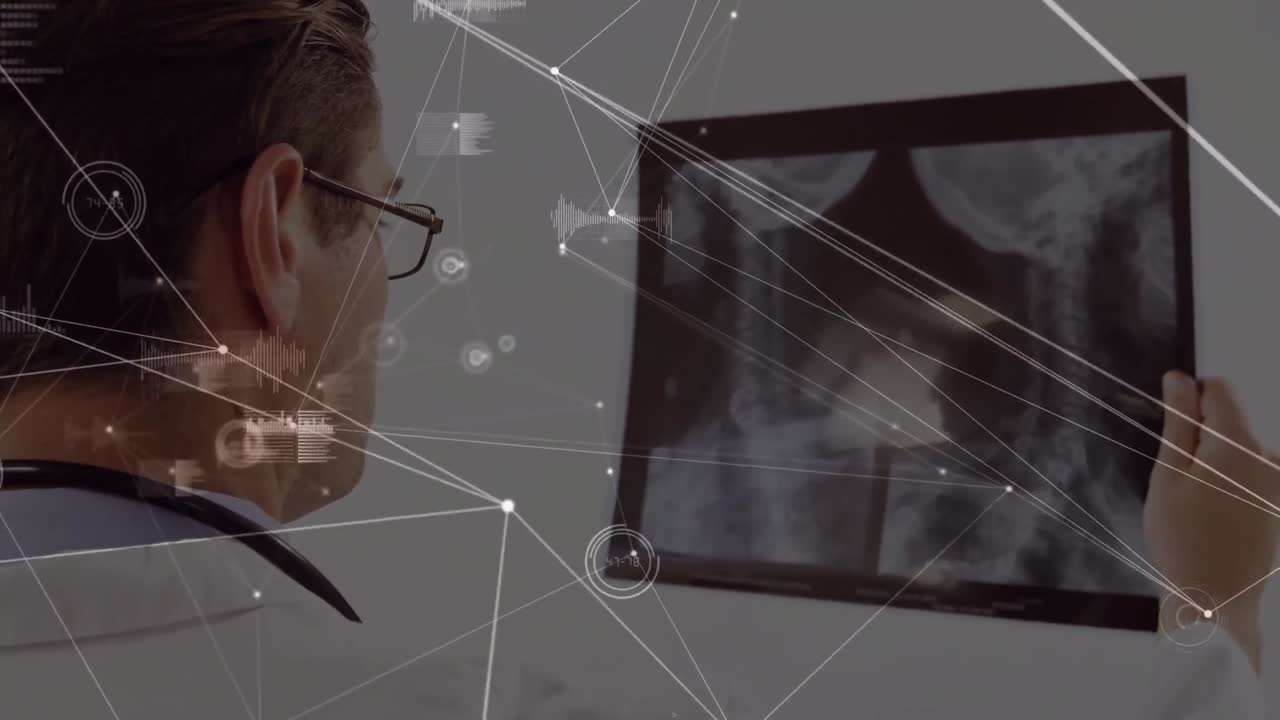 Animation av nätverk av anslutningar över en kaukasisk manlig läkare med röntgenbild