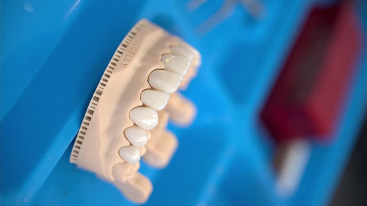 Dolly in closeup shot of a set of ceramic composite veneers placed on a silicone mold