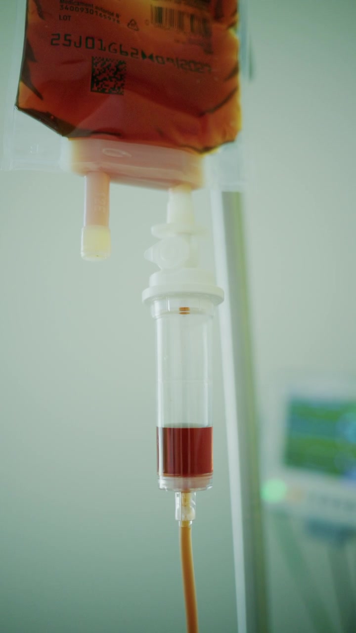Primo piano di una sacca di sangue collegata a una camera di gocciolamento per flebo, che somministra sangue durante un trattamento medico.