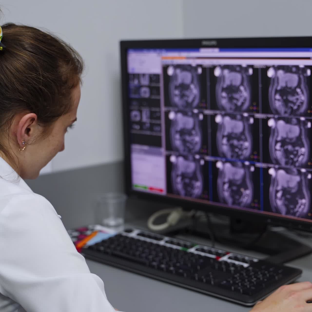Giovane specialista di laboratorio esamina le scansioni ottenute da una risonanza magnetica. Moderno laboratorio ospedaliero per diagnosi precise