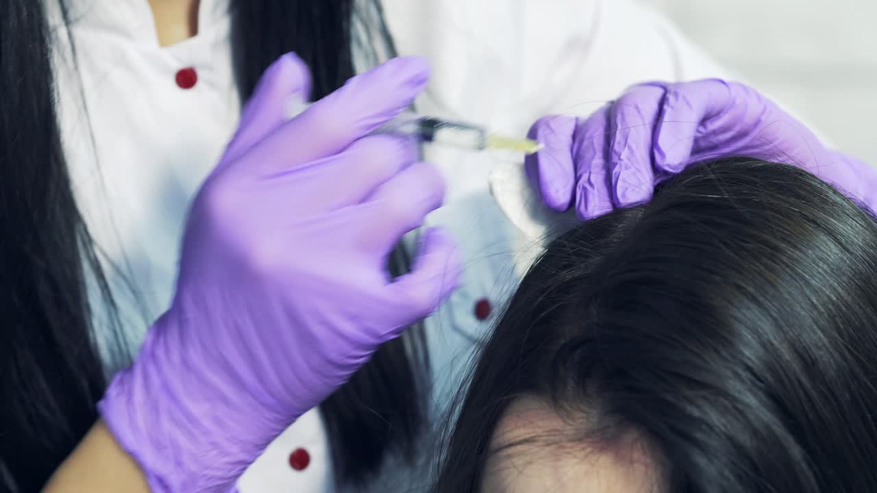 Hands of a doctor with an injection syringe pricking the patient's head to treat hair growth in the cosmetologist's office. Young woman with hair loss problem receiving injection. Close-up