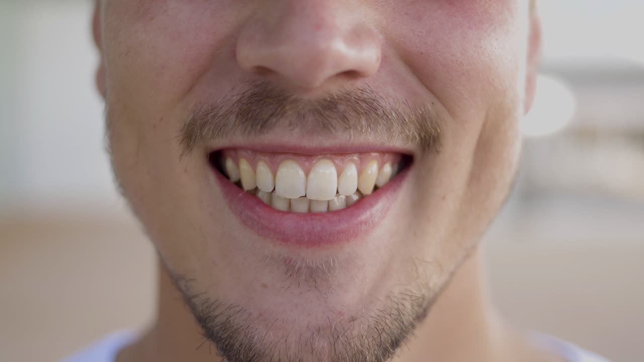 una foto cortada de un hombre barbudo sonriente.