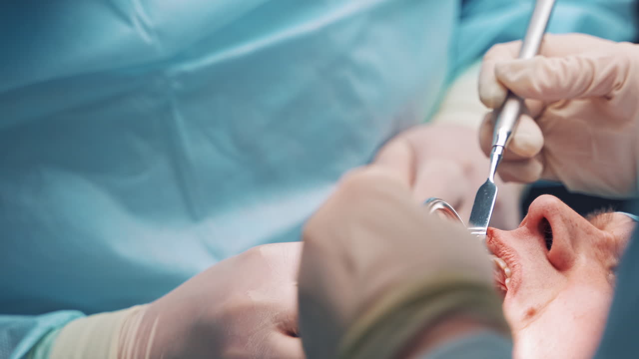 Dentist's hands inserts metal pin to the patient's mouth in clinic. Stomatologist and a nurse doing dental operation in the hospital. Close-up. Oral surgary.