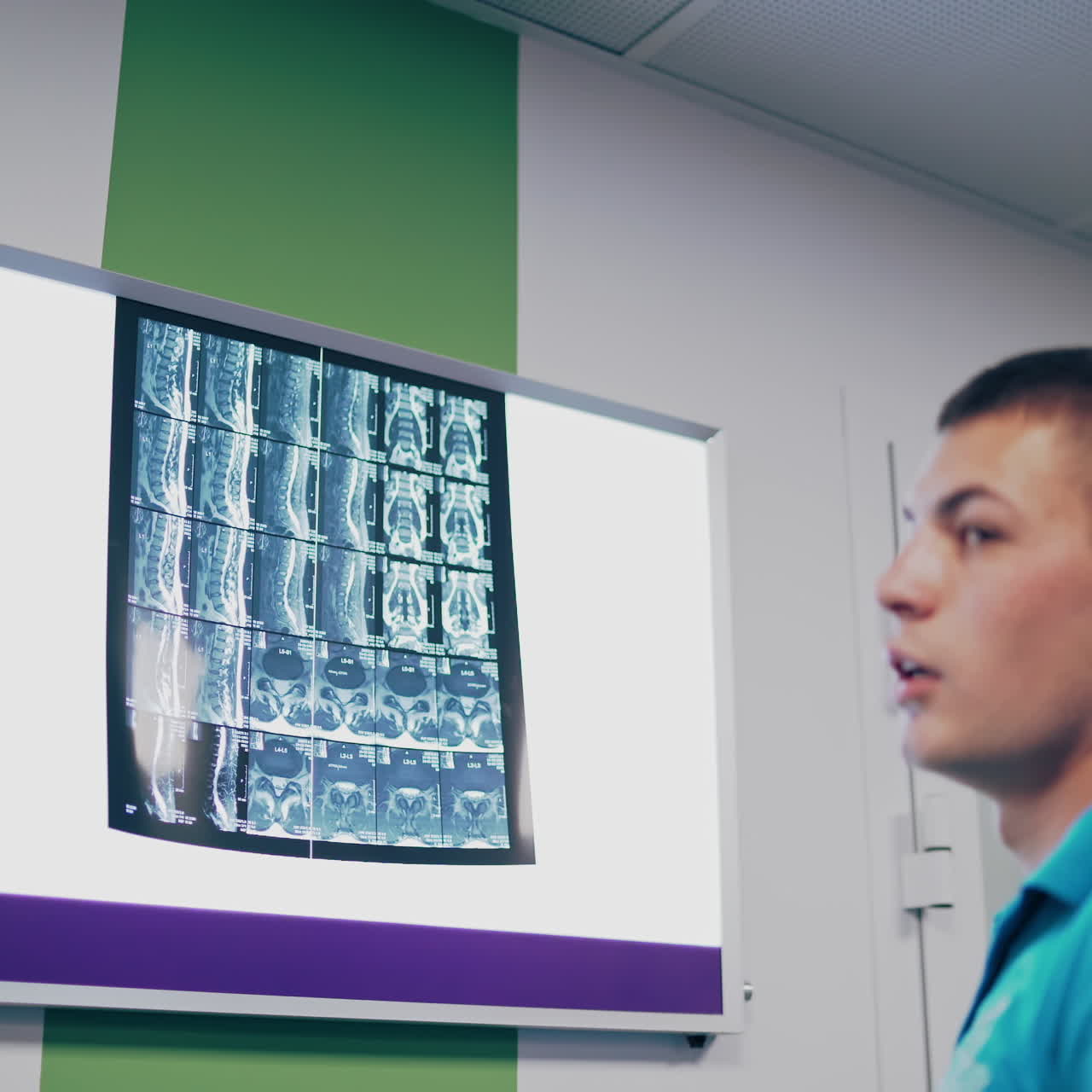 Doctor man is looking to the spine x-rays and explains the back problem in clinic. X-ray photograph hanging on a white board and a young specialist makes the diagnosis due to this scan.