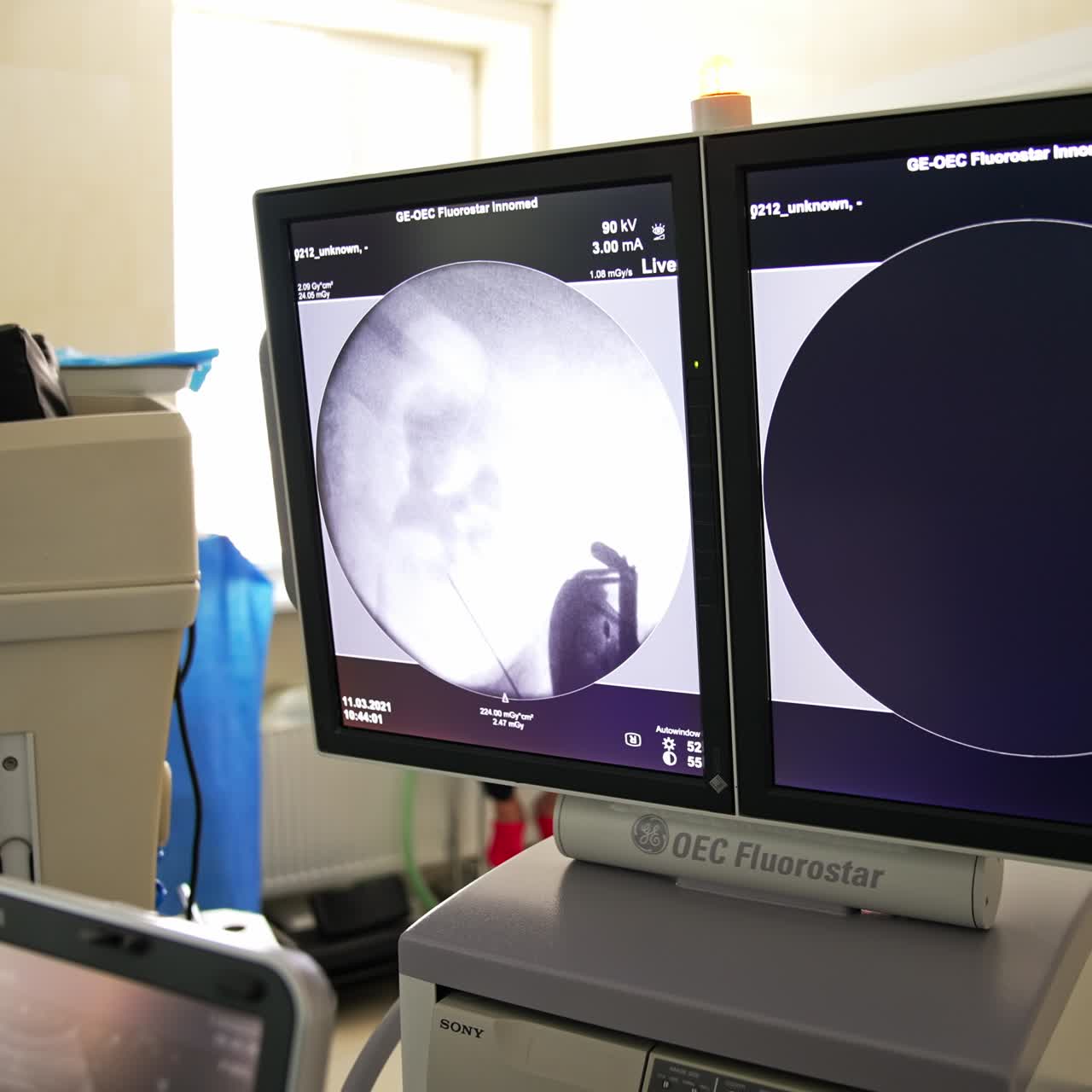 Monitoraggio dell’assistenza sanitaria dei pazienti in sala operatoria. Moderne tecnologie di emergenza
