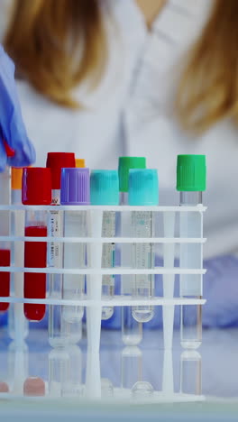 scientist holding test tube. technician of health with blood tubes in the clinical lab for analytical
