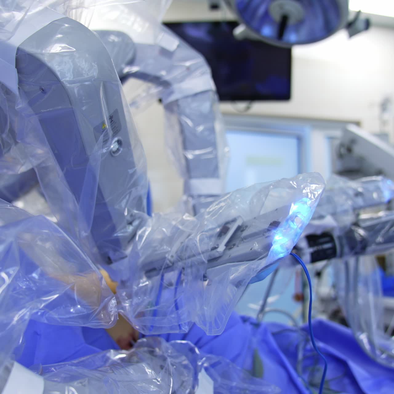 Da Vinci manipulator arms slowly moving over the operational table. Advanced robotic equipment performing endoscopic surgery in modern hospital